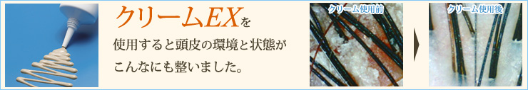 ケフトルクリームEXを使用すると頭皮の環境と状態がこんなにも整いました。